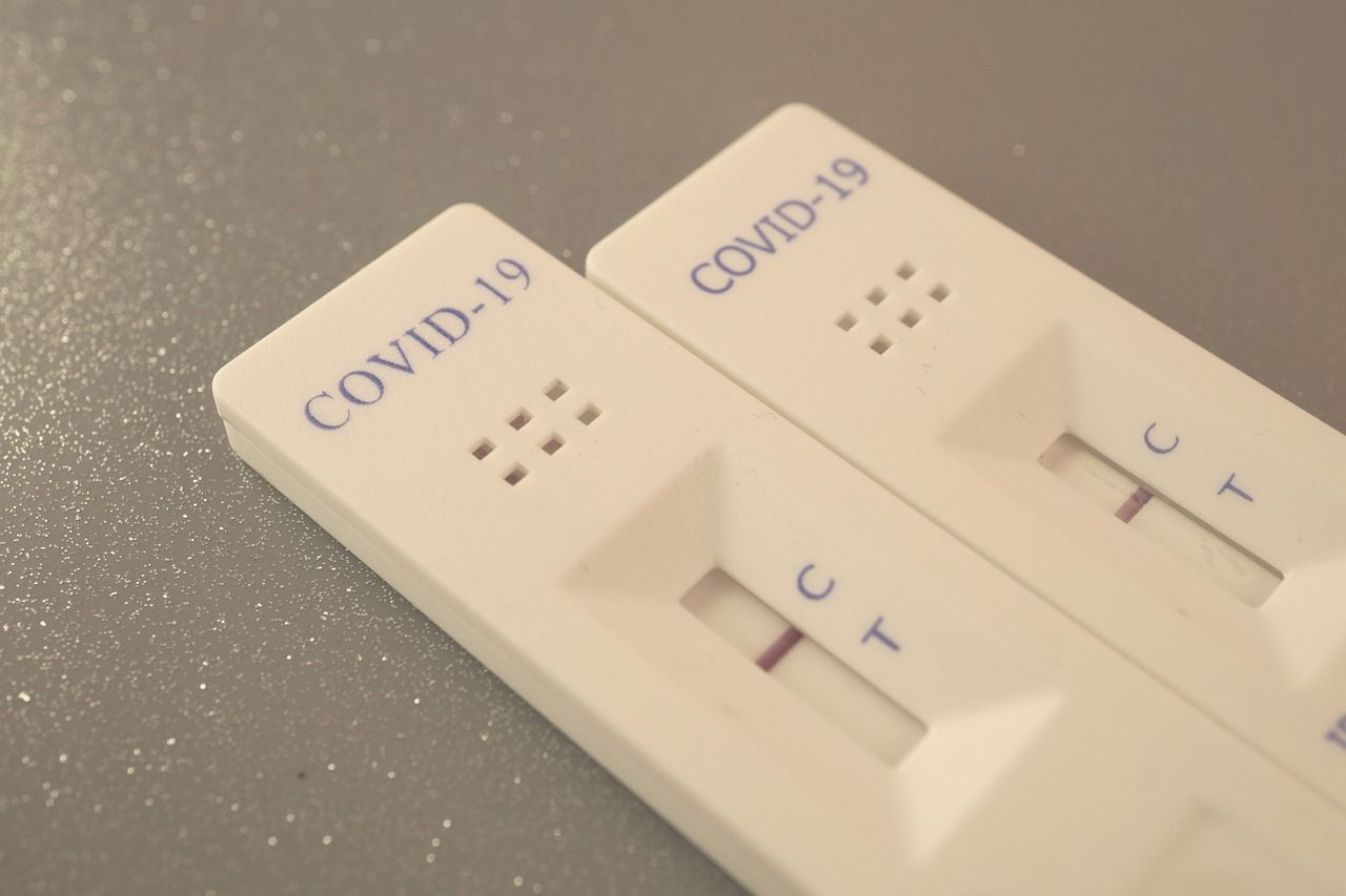 ¿Dónde puedo hacerme la prueba PCR de COVID-19 y cuánto cuesta?