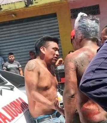 Amigo atropellado terminó en el hospital