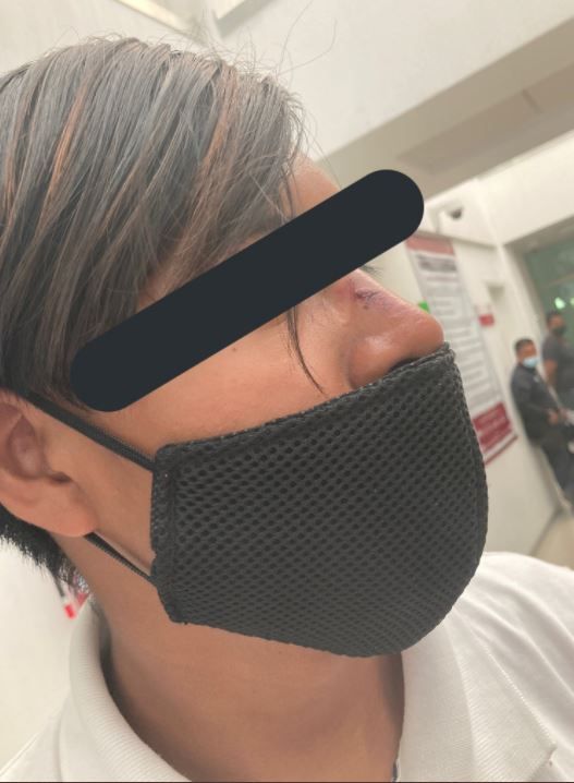 Guardia de seguridad agredida Zumpango