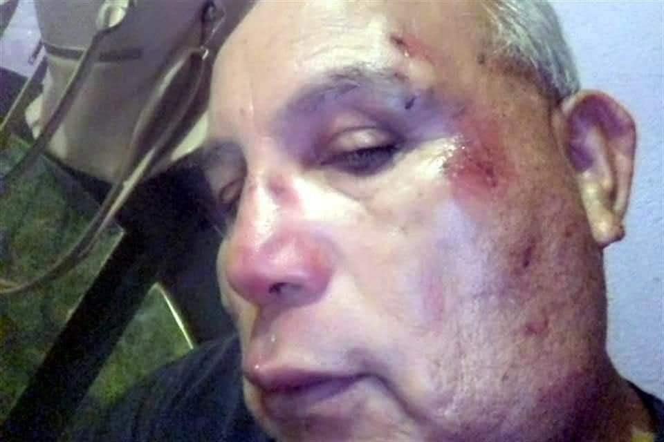 ¿Qué dijo el adulto mayor agredido en NL?