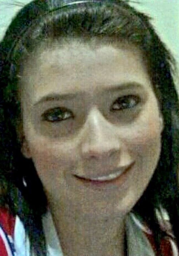 Brenda Zambrano. Antes y después de las cirugías