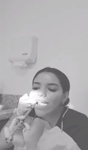 Dentista muestra en video que se extrajo las muelas sola
