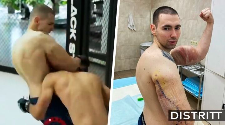 Popeye ruso. Brazos le explotan en plena pelea |VIDEO