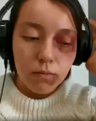 Maestra descubre en clase que su alumna es golpeada |VIDEO 