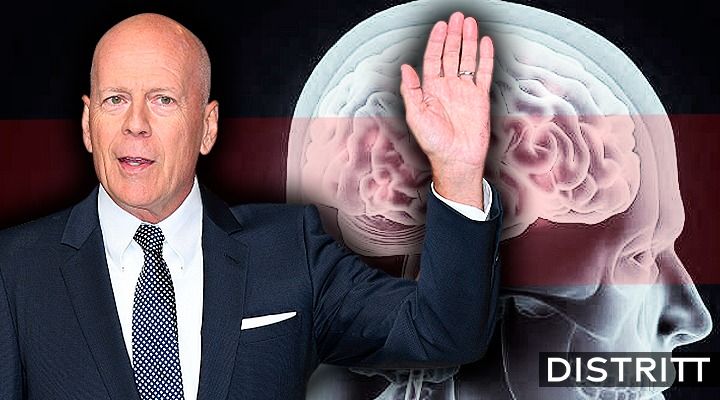 ¿Qué es la afasia, enfermedad que padece Bruce Willis?