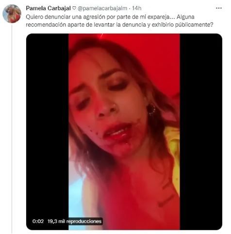 Pamela Carbajal de Enamorándonos denuncia agresión de su ex 