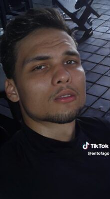 Marlon Colmenarez antes y después de las cirugías |FOTOS
