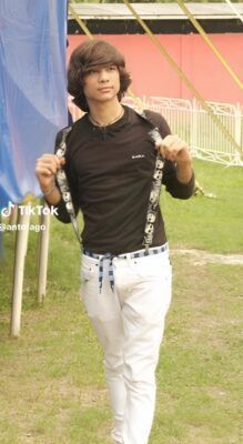 Marlon Colmenarez antes y después de las cirugías |FOTOS