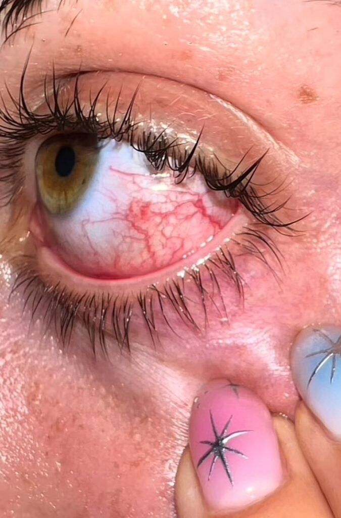 Ojo de influencer