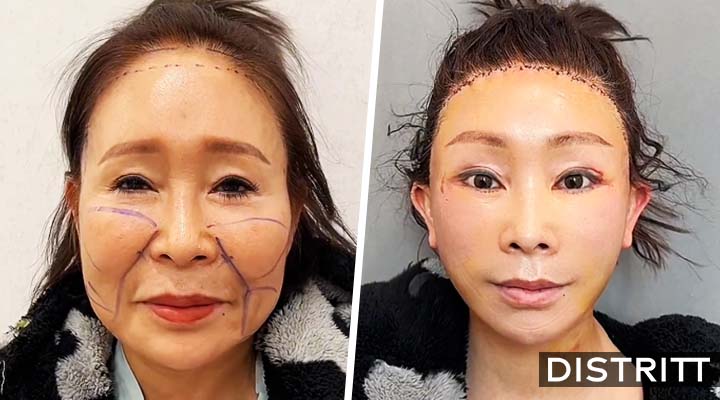 Dr Kim, cirujano que causa terror por sus resultados