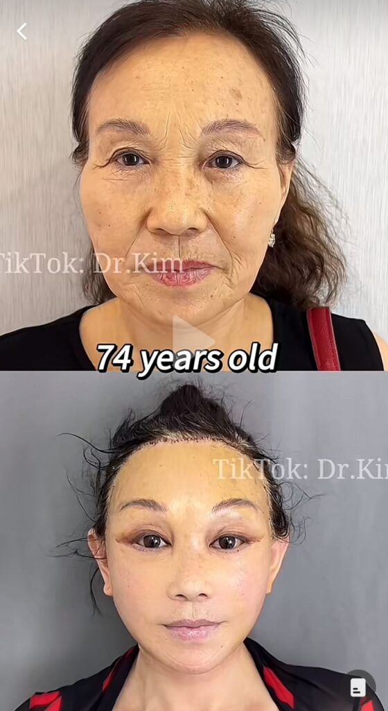Dr Kim en la mira por cirugías estéticas 