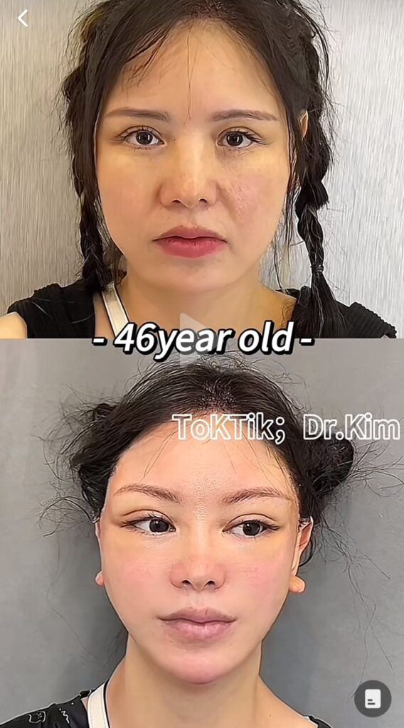 Dr Kim provoca pánico en TikTok 