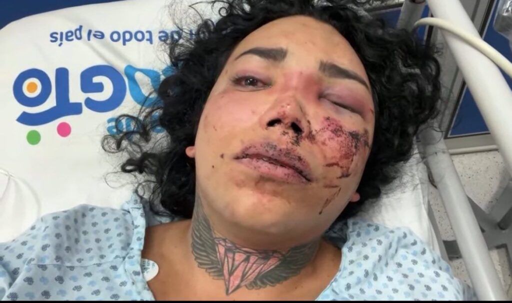 Novio de Paola Suárez la agrede y es hospitalizada