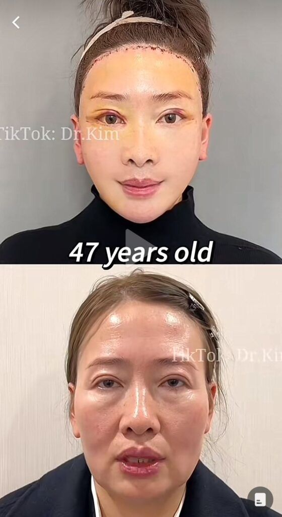 Tunden a Dr Kim en TikTok 