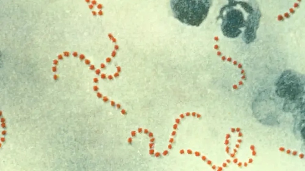 ¿qué es el estreptococos y cuáles son sus síntomas?
