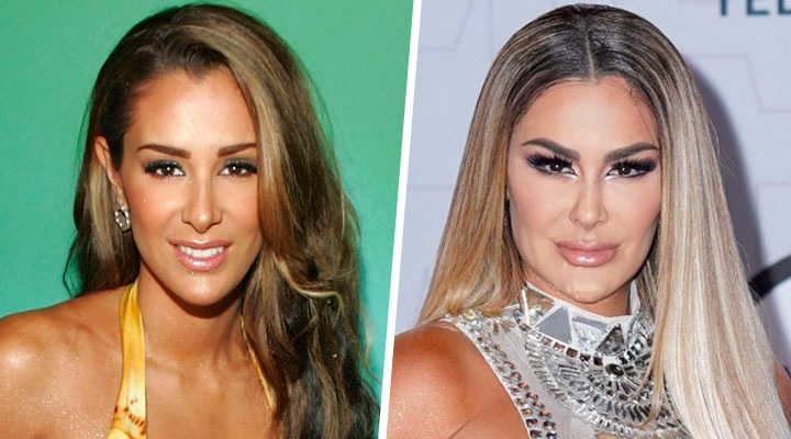 Antés y después de Ninel Conde