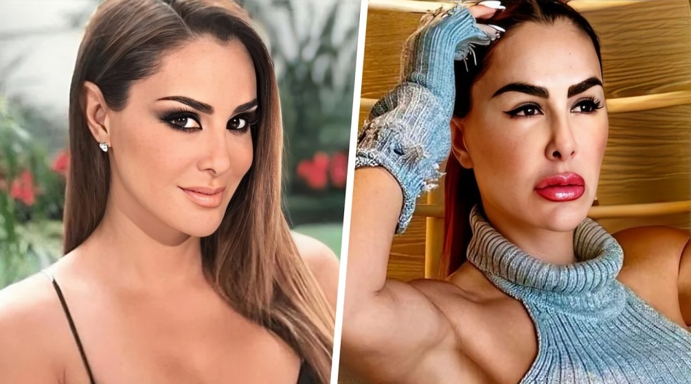 Antés y después de Ninel Conde