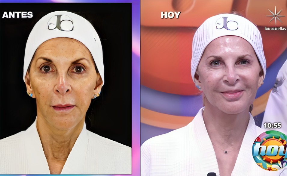 Shanik Berman tratamiento