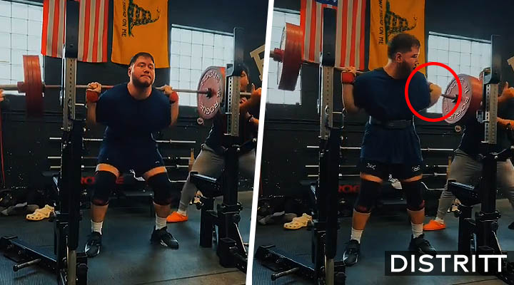 Hombre se rompe antebrazo por cargar de más en gym