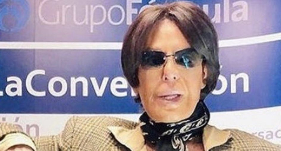 Alfredo Palacios antes y después de las cirugías