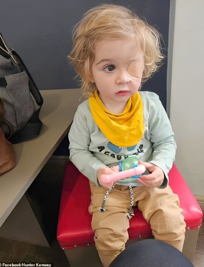 Niño de dos años pierde la vista tras beso