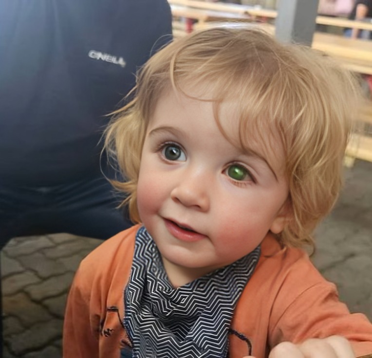 Niño pierde la vista tras recibir un beso en el ojo