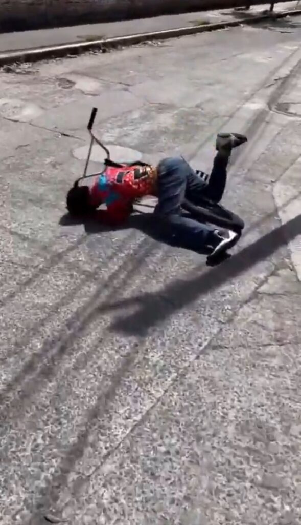 Joven cae contra bicicleta hieriendo sus genitales