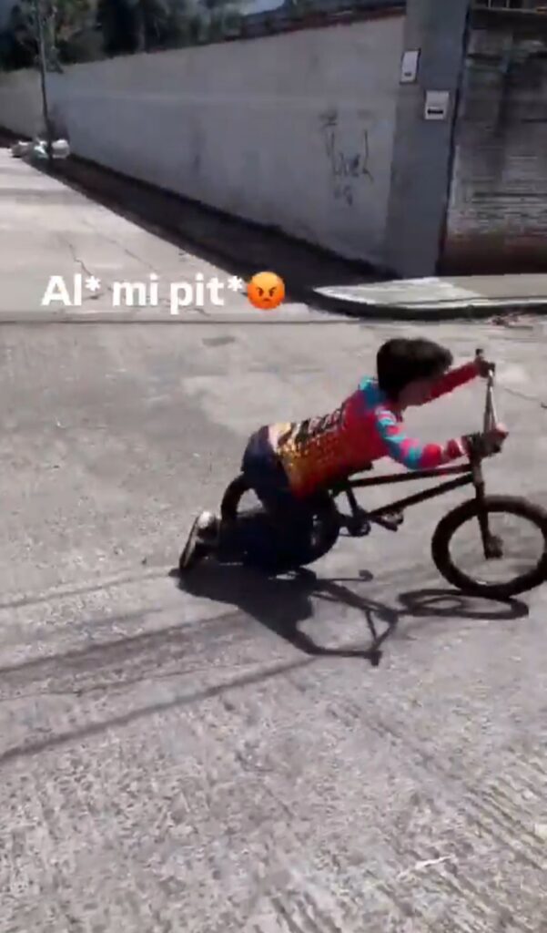 Joven se hiere sus gentiales al caer sobre su bicicleta