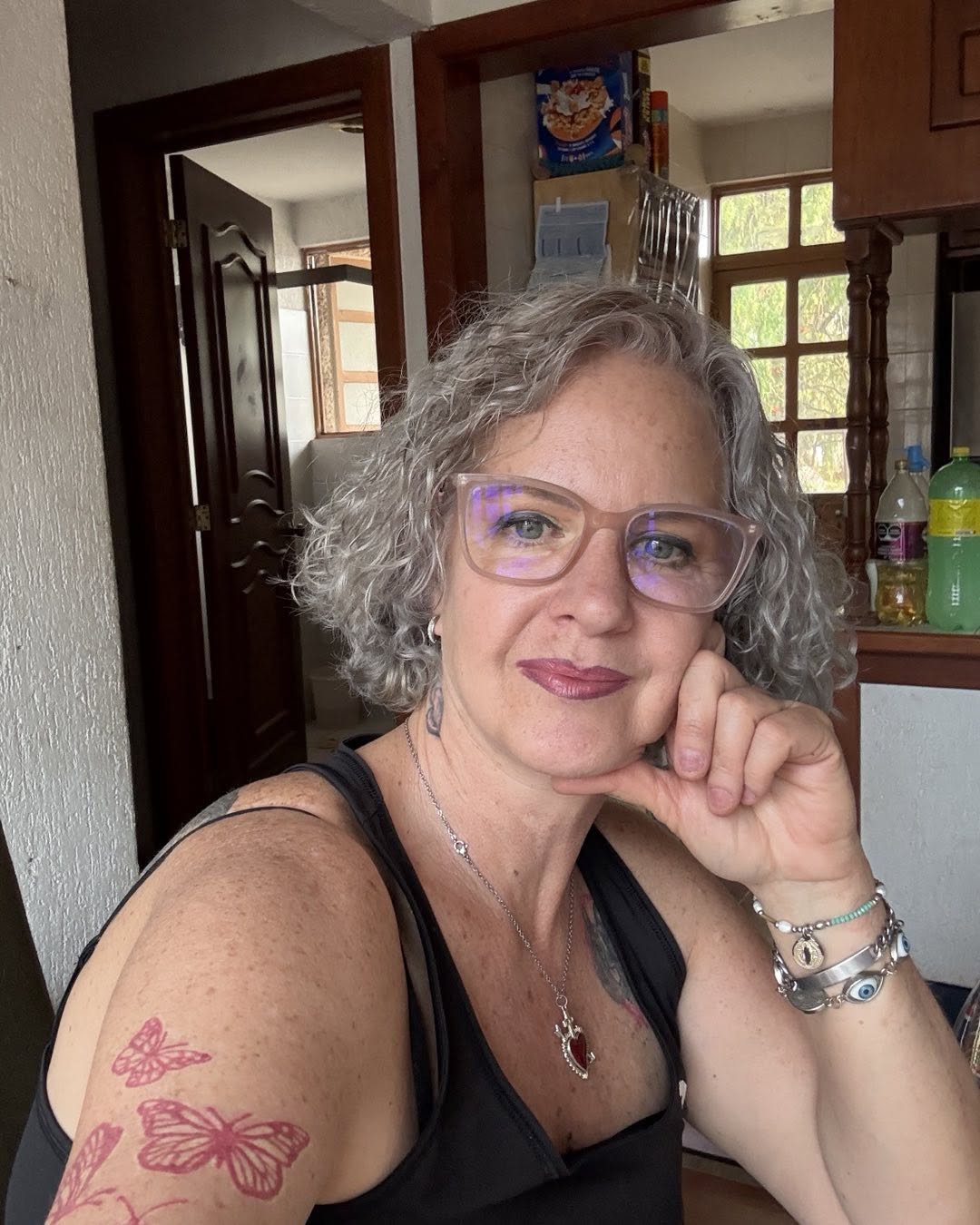 Mamá de Gala Montes presume resultado estético