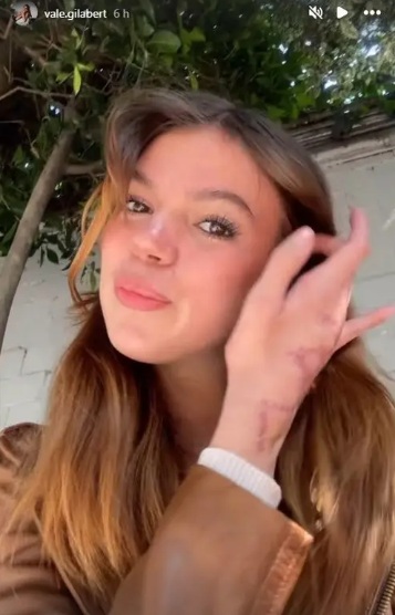 Valentina Gilabert muestra proceso de recuperación