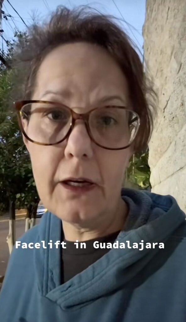 Mujer comparte resultados de cirugía facial en México