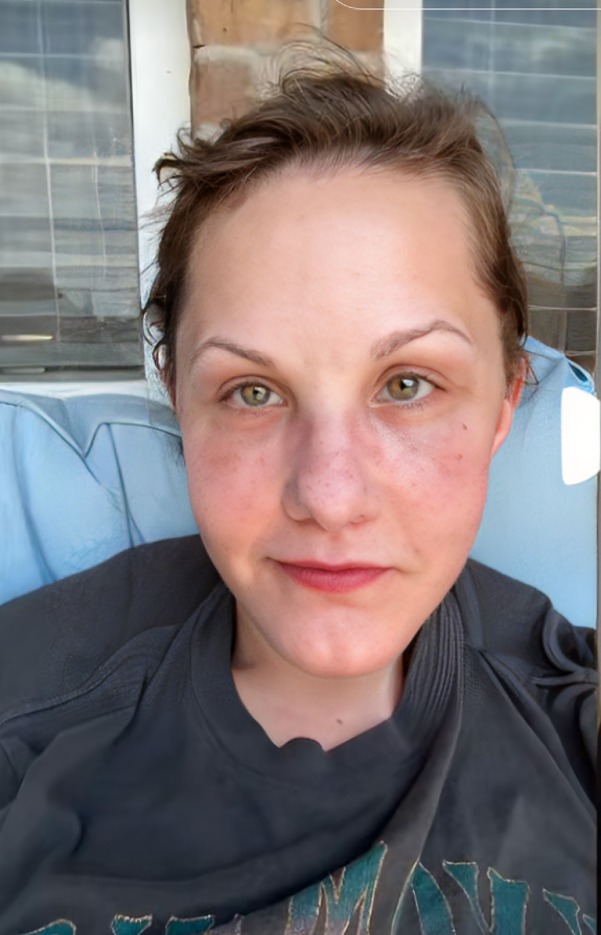 Mujer muestra cambio de rostro tras cirugía facial en Guadalajara