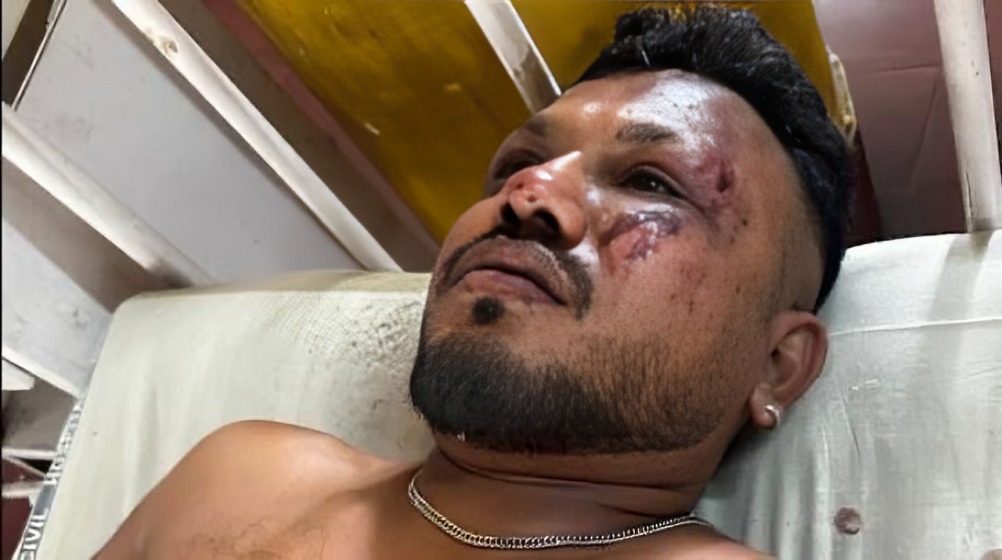 ¿Quién es Ramesh, único sobreviviente del accidente del Air India?