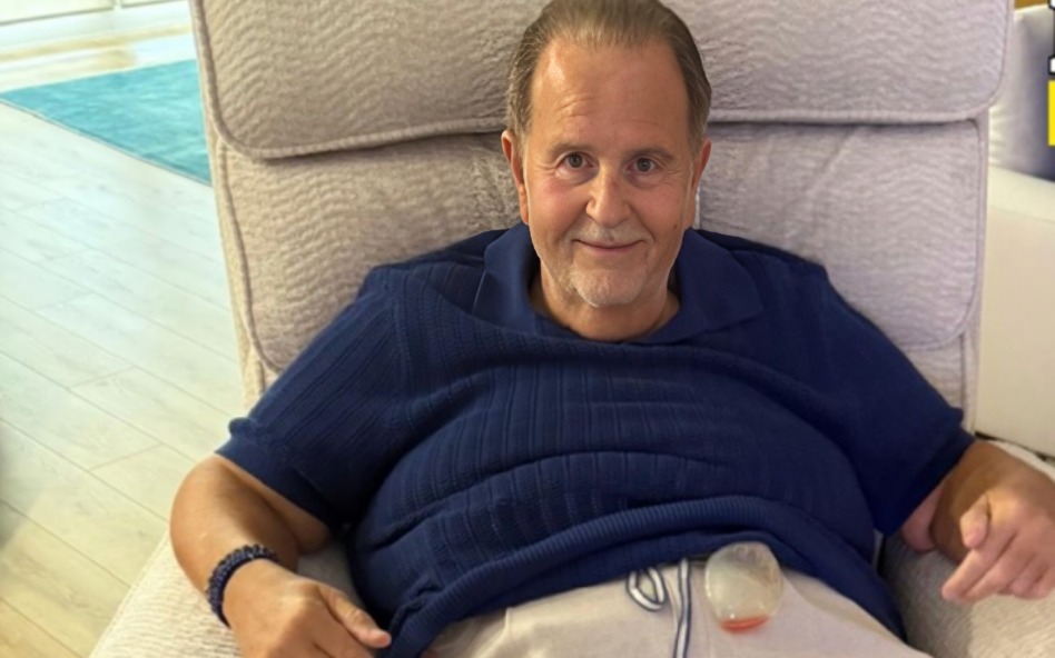 Raúl de Molina se smetió a abdominoplastia