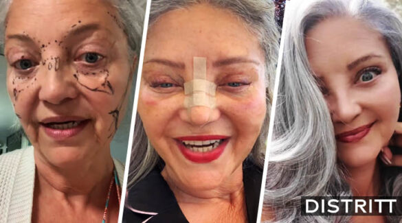 Abuelita se somete a cirugía estética; resultado se viraliza