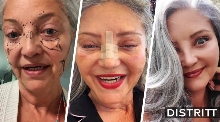 Abuelita se somete a cirugía estética; resultado se viraliza