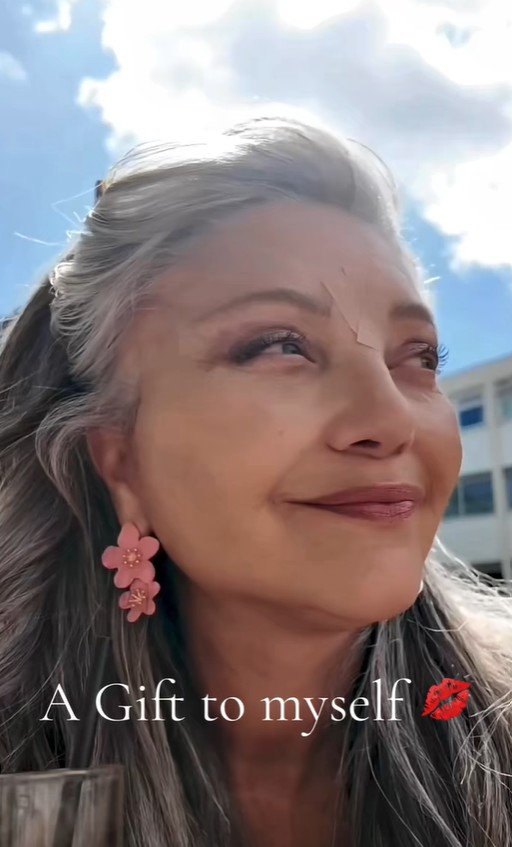 Abuelita presume cirugía estética