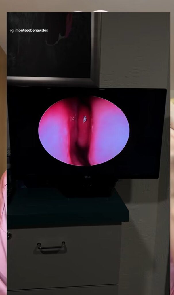 Joven relata resultados fallidos de su rinoplastia