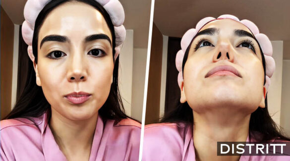 Joven se hace rinoplastia y termina mal; caso viral