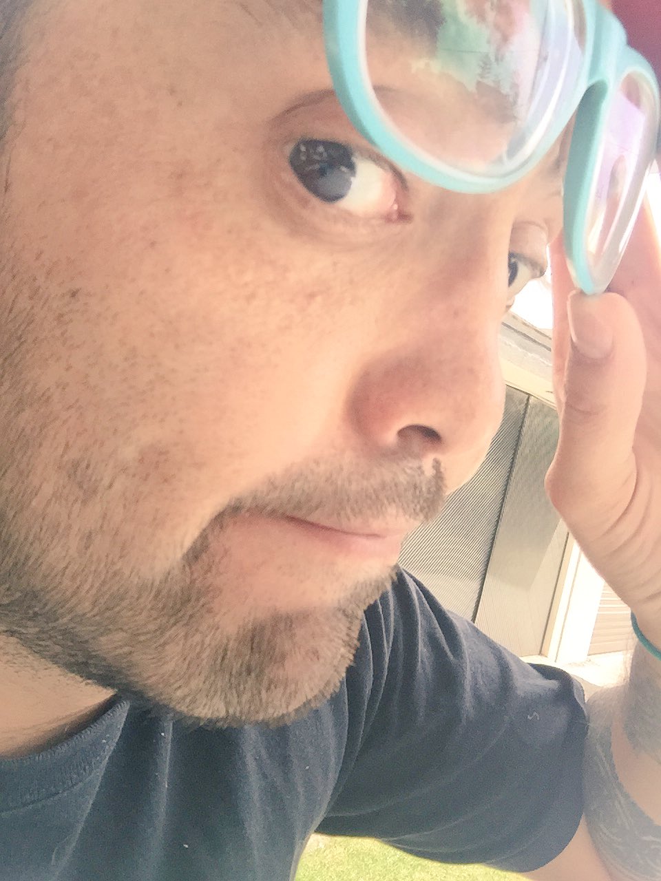 ¿Qué le pasó en la nariz a Mauricio Clark? Antes y después