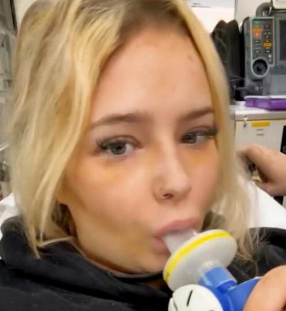 Influencer muere al aspirar gas de la risa de un globo