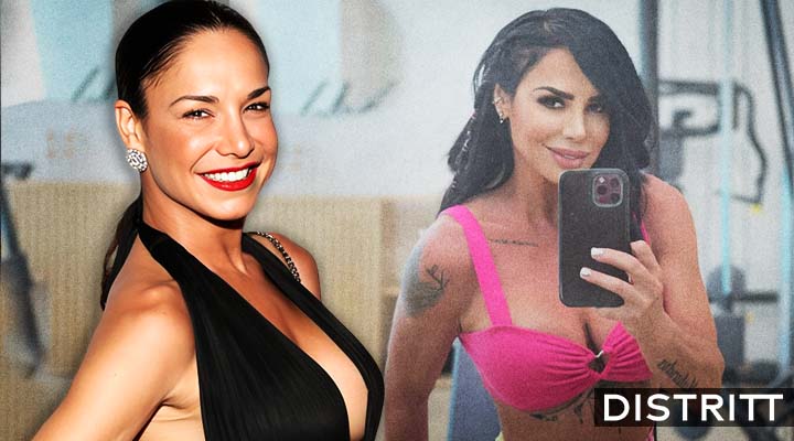 Lis Vega antes y después de las cirugías