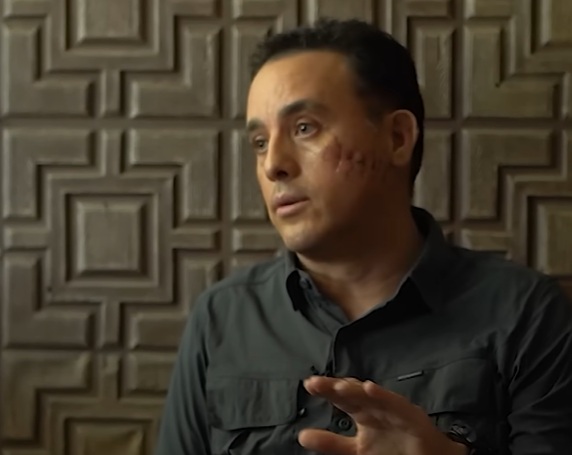 ¿Qué daños recibió Mauricio Hoyos?