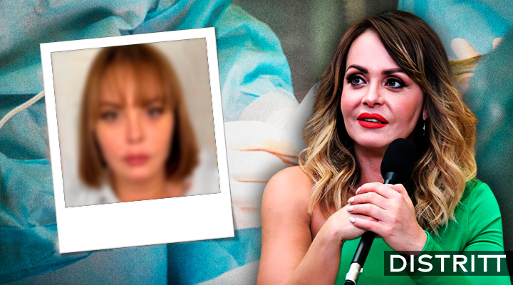 Gaby Spanic presume radical rejuvenecimiento de rosto