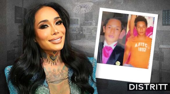 Karina Torres antes y después de las cirugías