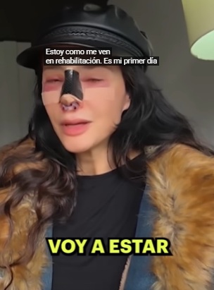 ¿Qué le pasó a Dorismar tras operarse?