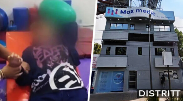 Joven pide rinoplastia como regalo de XV años y termina con infarto cerebral
