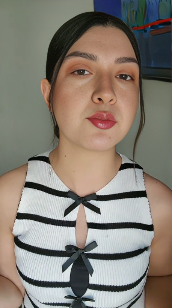 Mujer dona su riñón a novio como acto de amor