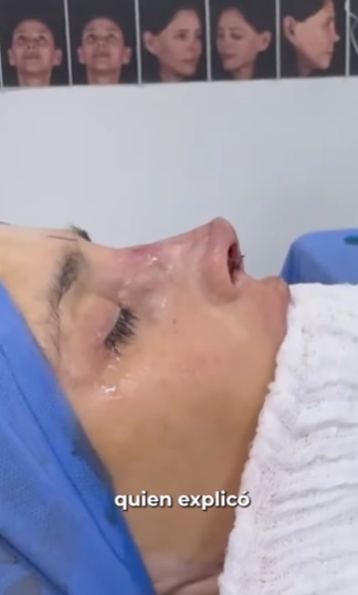 La amputación y la necrosis que desfiguraron el rostro de Dorismar