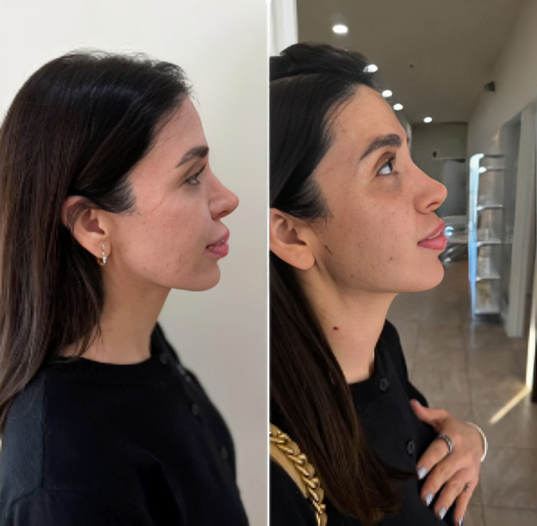 ¿Qué pasó con Emma Coronel? Así luce esposa de El Chapo